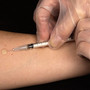 Zaniechanie szczepień może prowadzić do nawrotu epidemii chorób zakaźnych